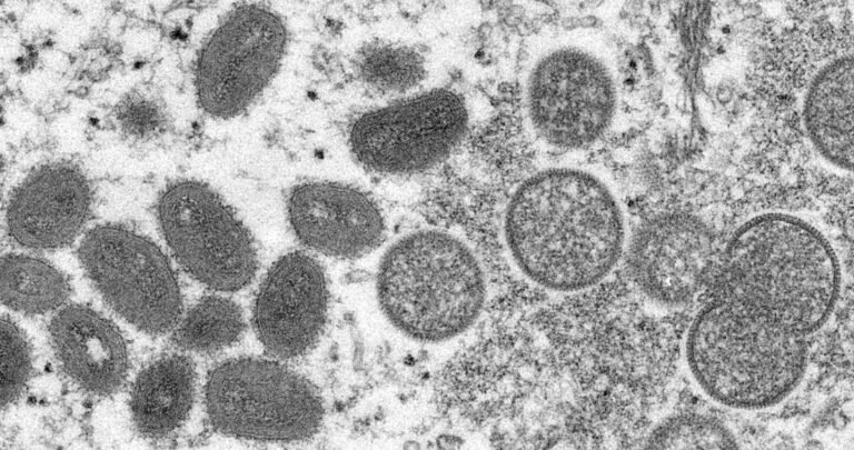 La OMS confirma más de 1, 000 casos de viruela del mono y advierte de transmisión comunitaria